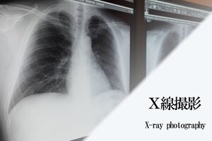 X線撮影